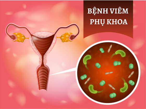 viem-phu-khoa-1.png