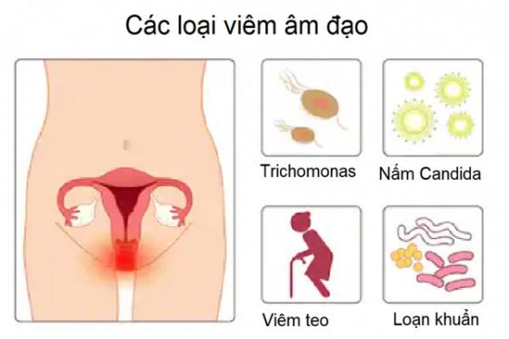 cac-loai-viem-am-dao.jpg