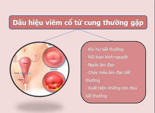 dauhieuthuonggapviemcotucung.png